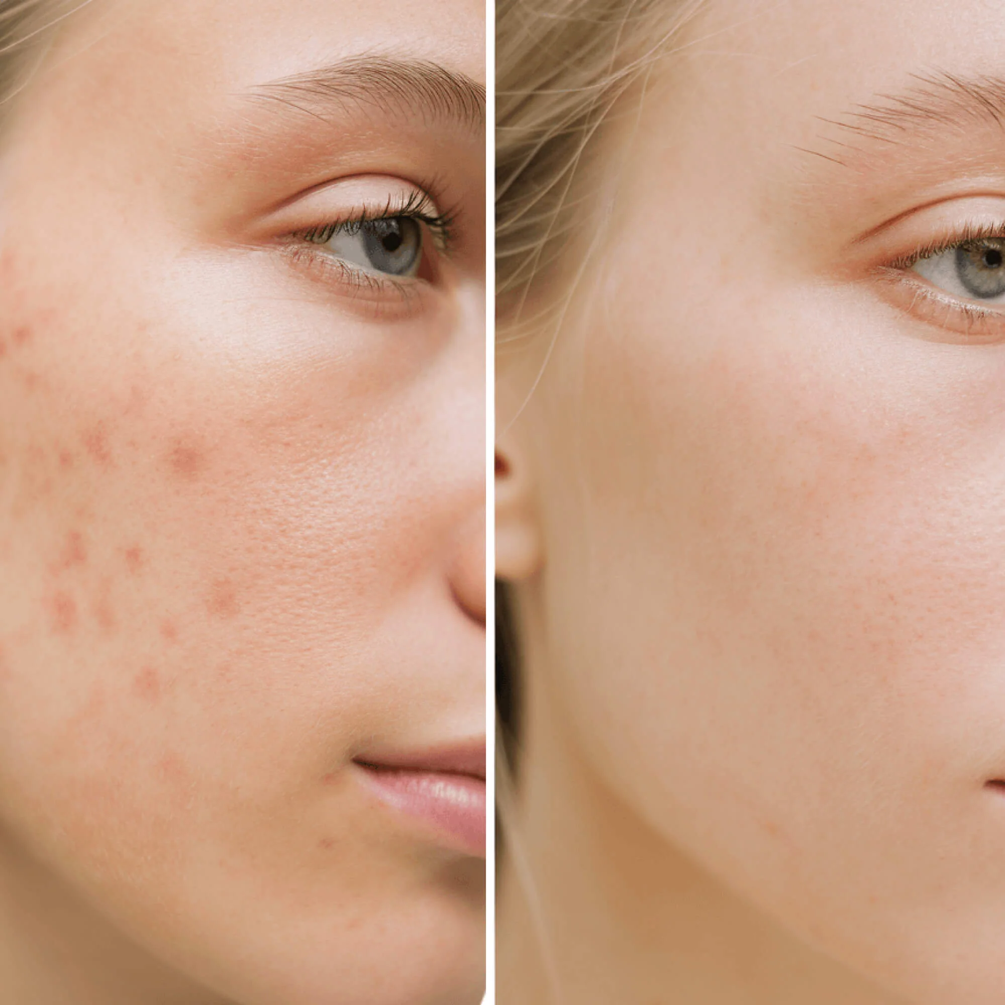 Vegan Cleansing Face Scrub (2-in-1 Exfoliating Scrub for Acne & Blackheads) - Image 5