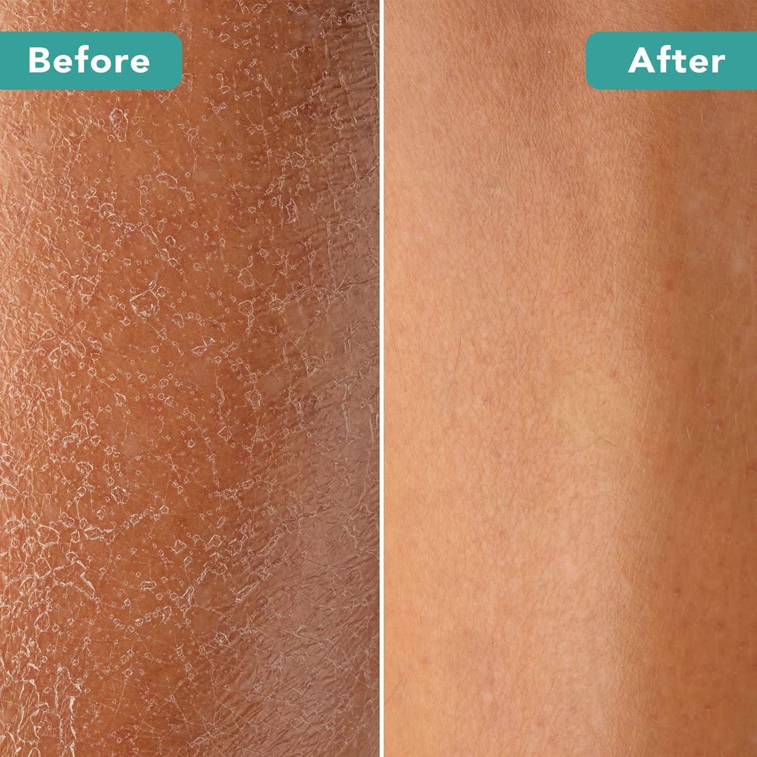 Dry Brush With Cellulite Massager - Image 3