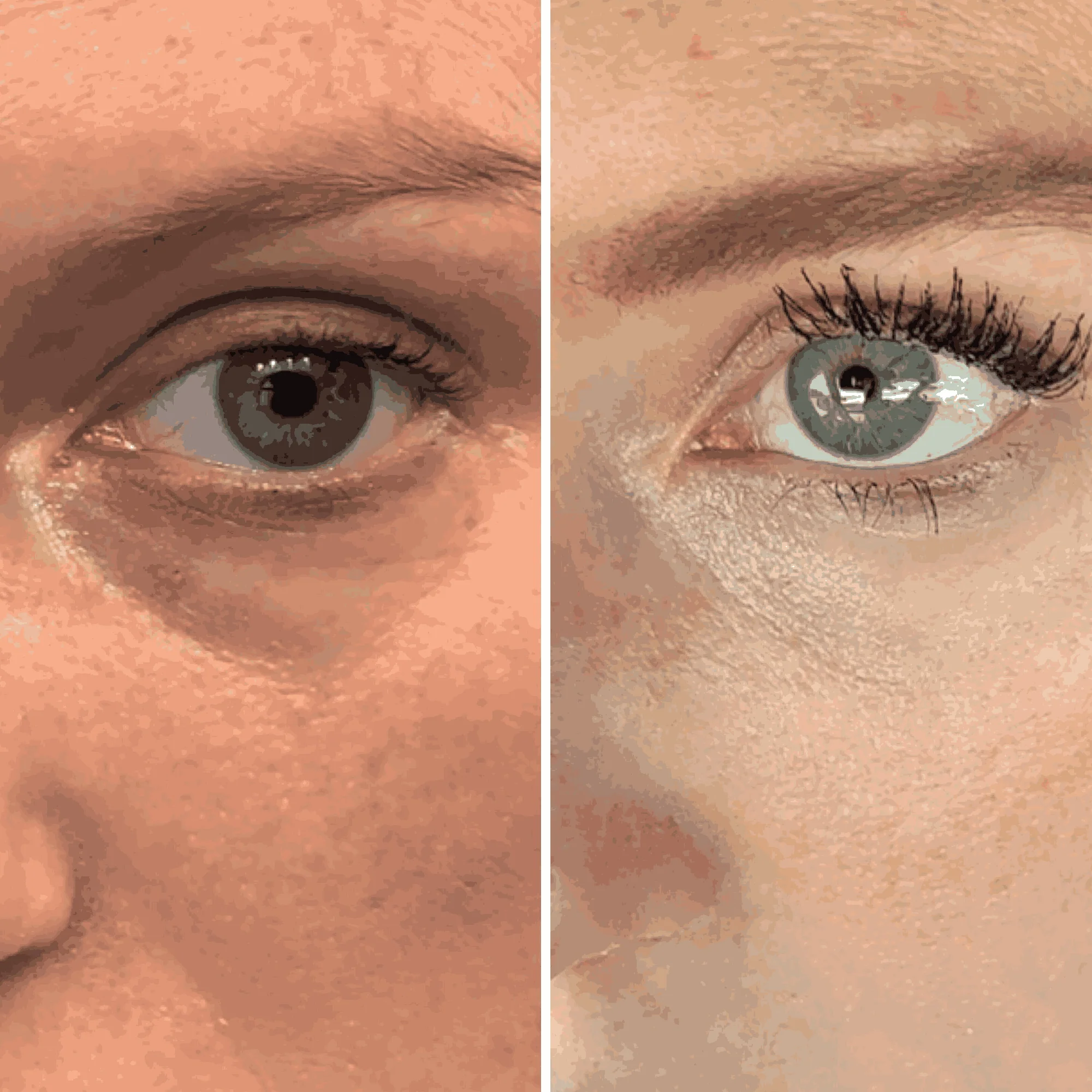 Hyaluronic Acid Eye Gel - Image 5