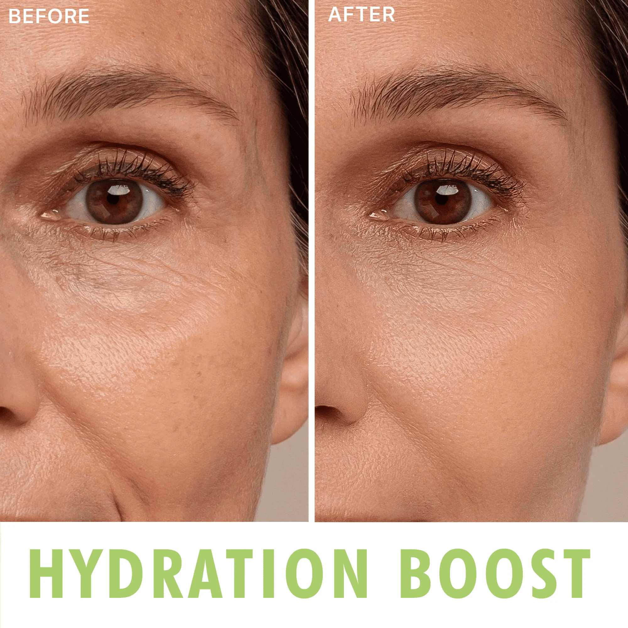 Hyaluronic Acid Quad Bundle - Image 5