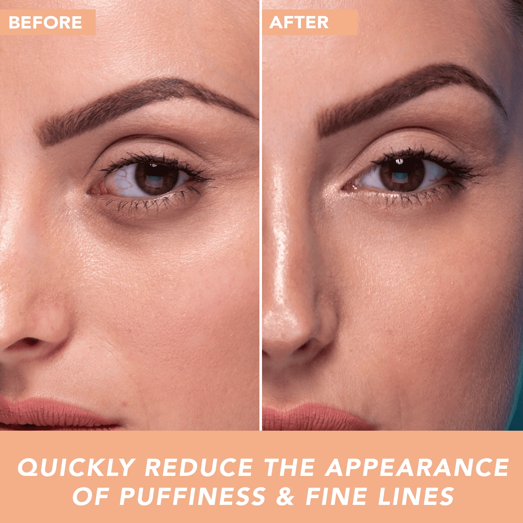 Hyaluronic Acid Trio Bundle - Image 8