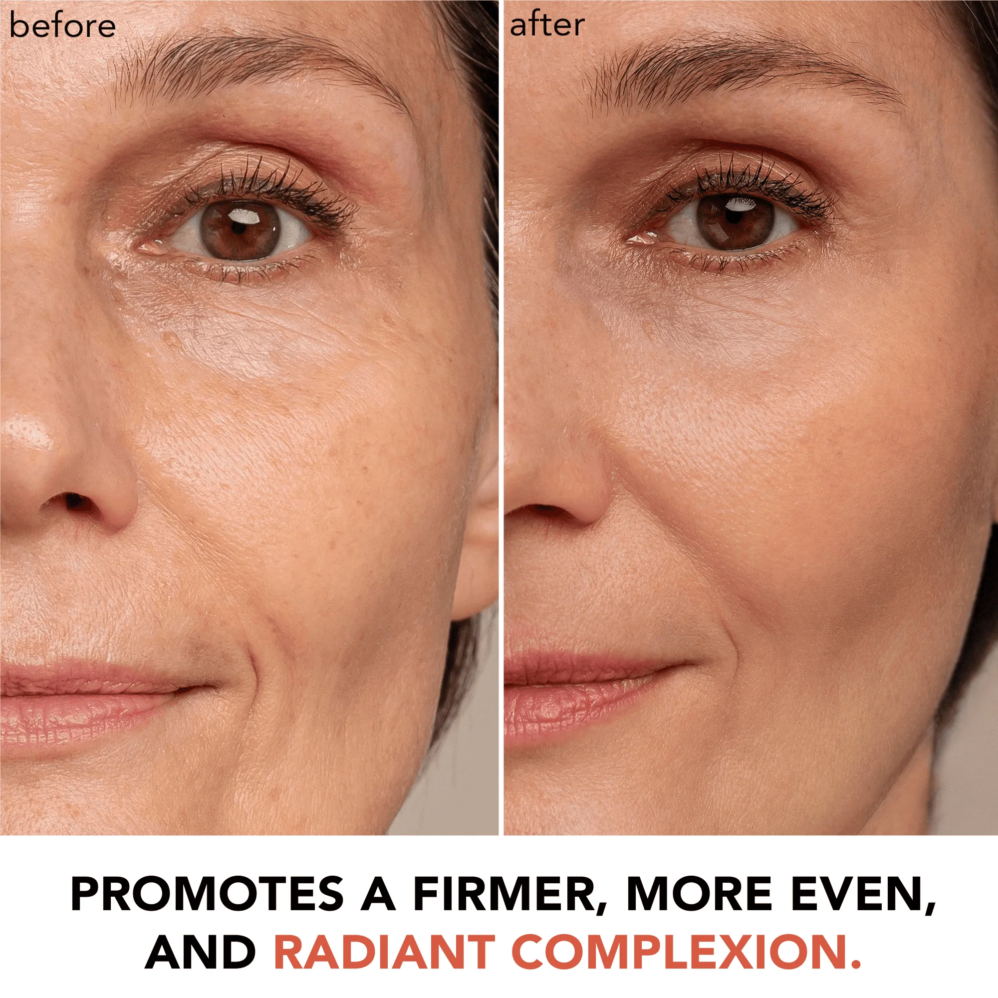 Hyperactive Anti-Aging® Vitamin C Duo - Image 8