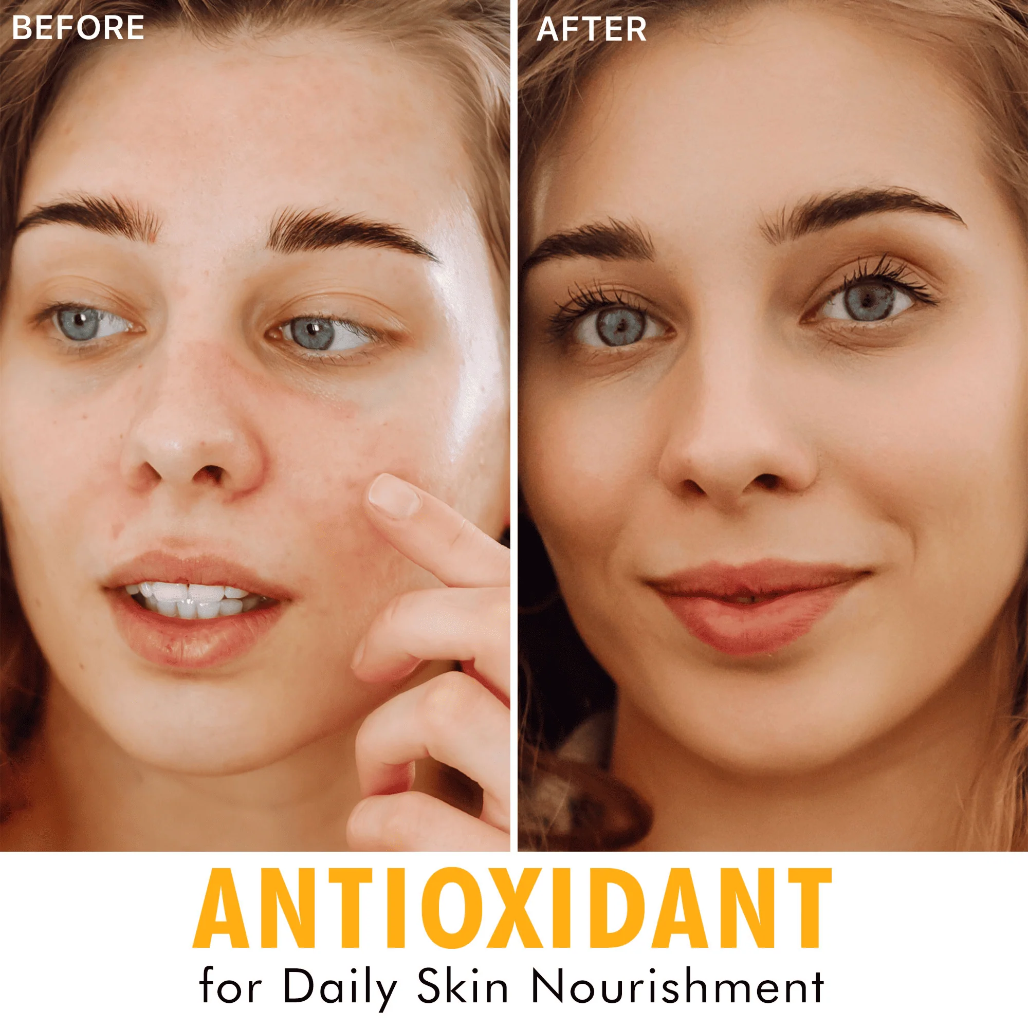 Hyperactive Anti-Aging Vitamin C Trio - Image 5