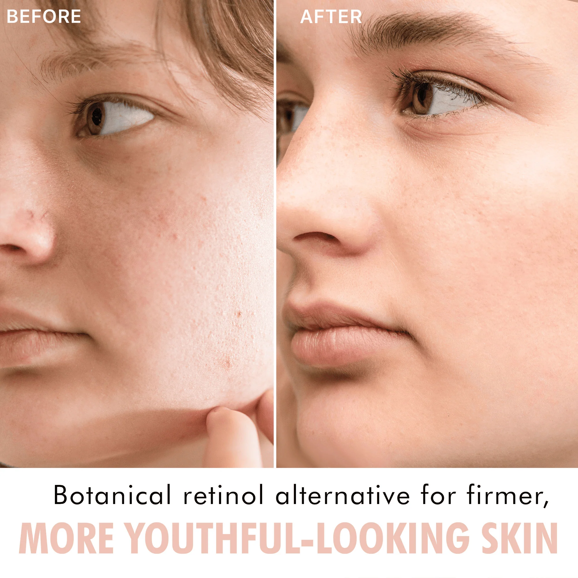 YouthRestoration Bakuchiol Face Serum - Image 4