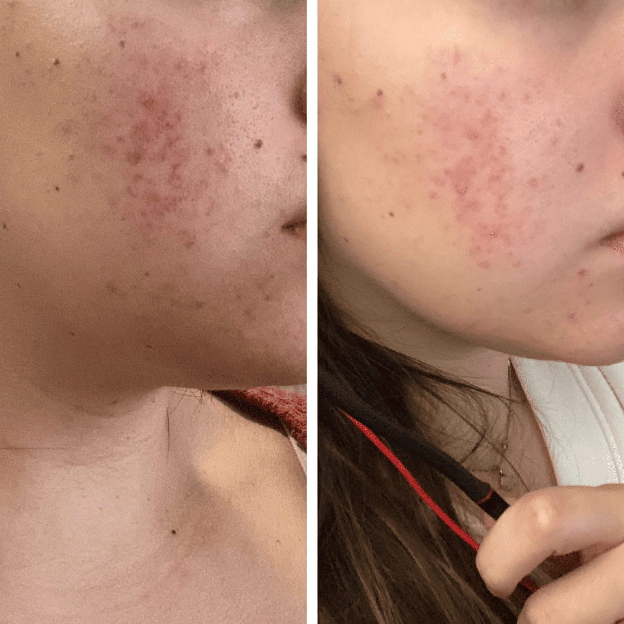 YouthRestoration Bakuchiol Face Serum - Image 5