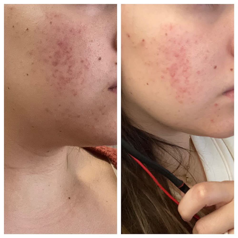 YouthRestoration Bakuchiol Face Serum (SECRET DEAL) - Image 2