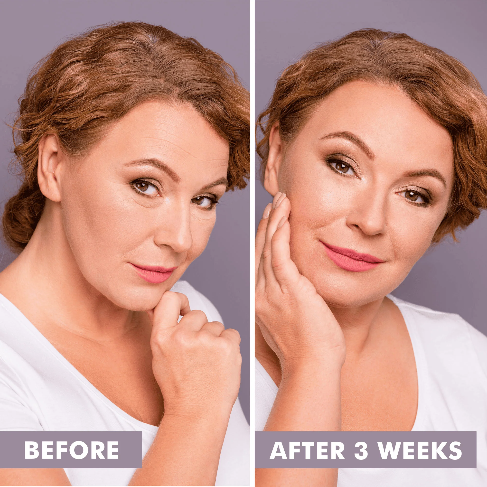 YouthRestoration Bakuchiol Face Toner - Image 7